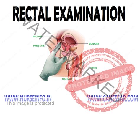 anal checkup|Examination of your anus and rectum (back passage).